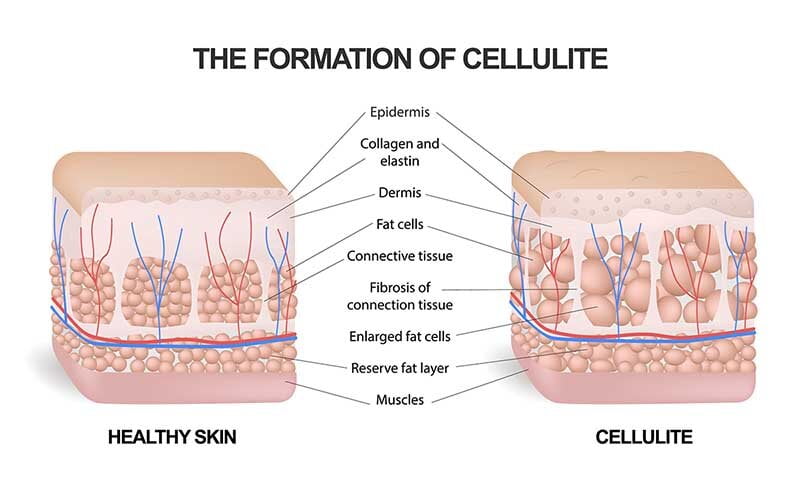 Wat is bindweefsel Wat is bindweefsel